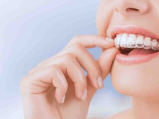 Wie man auf Reisen mit verlorenen oder kaputten Alignern umgeht – Täglich filmen