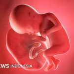 Kesehatan: Sindikat perdagangan plasenta bayi yang pasok bahan 'obat awet muda' ditangkap di Pakistan