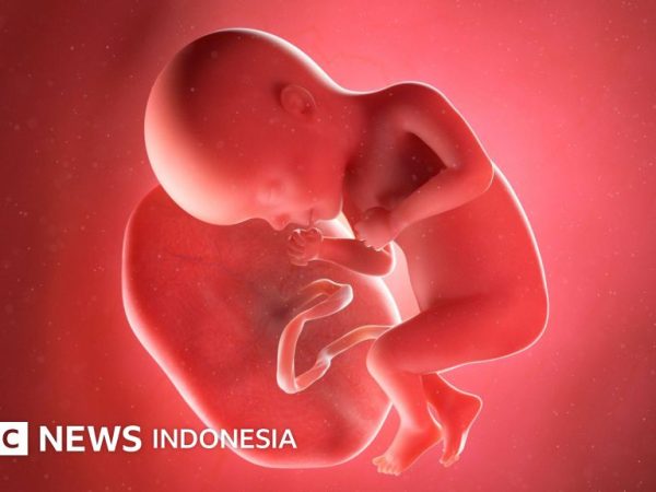 Kesehatan: Sindikat perdagangan plasenta bayi yang pasok bahan 'obat awet muda' ditangkap di Pakistan